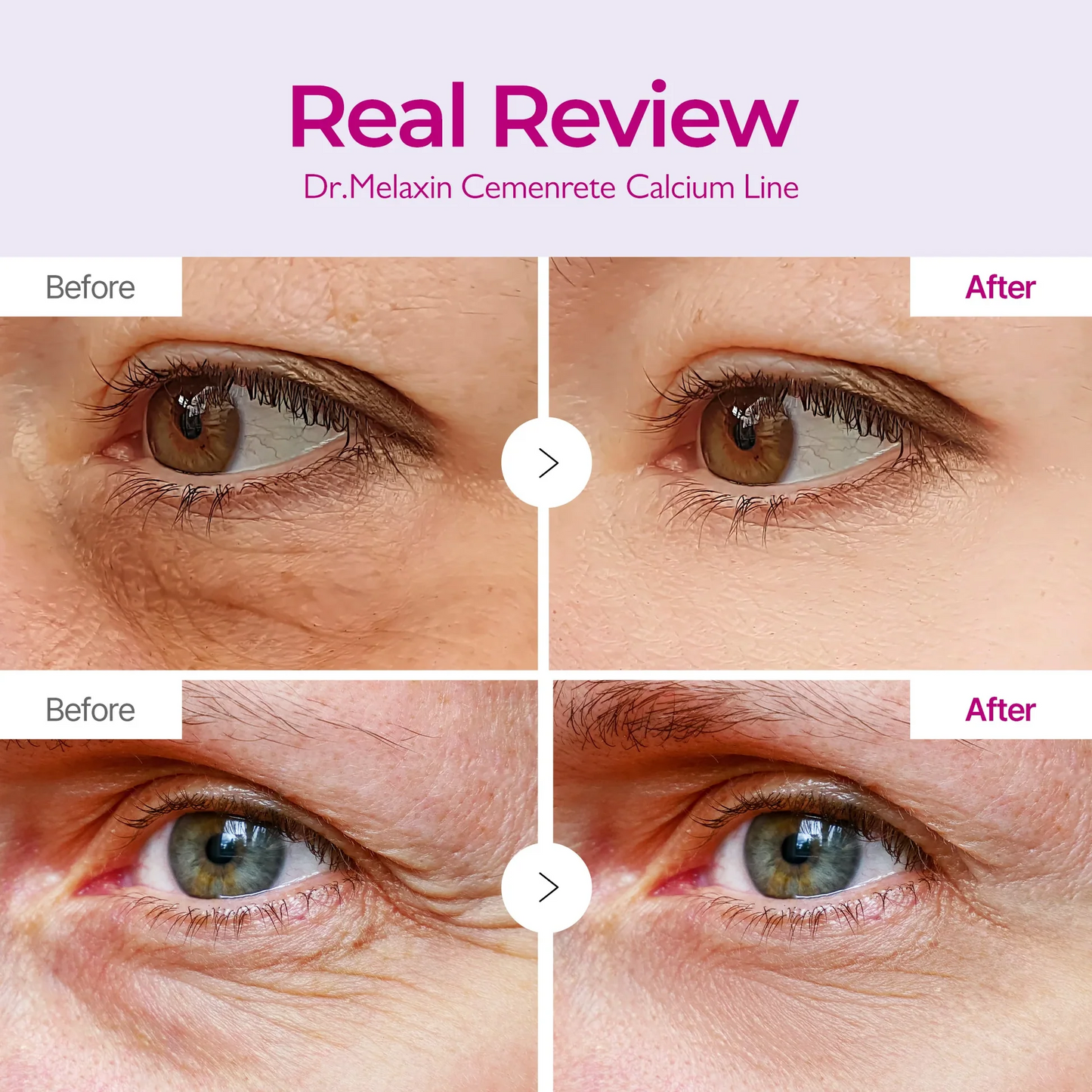 Dr. Melaxin™ Cemenrete Calcium Eye Lift Duo
